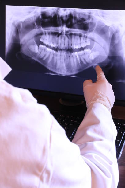 Best Emergency Tooth Extraction in Bridgetown, OH
